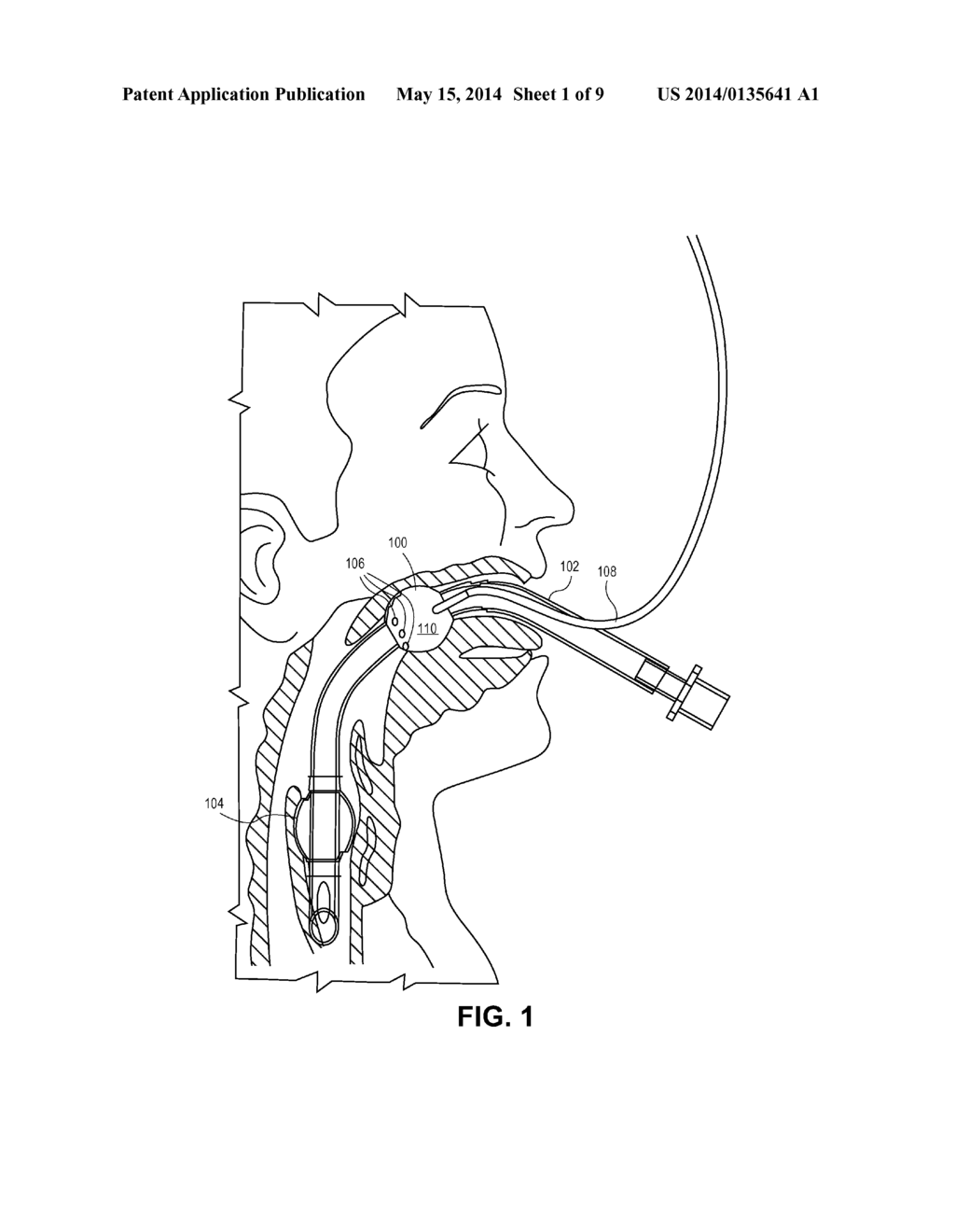 DEVICE FOR EVACUATING AND/OR MONITORING GAS LEAKING FROM A PATIENT DURING     SURGERY OR ANESTHETIZATION - diagram, schematic, and image 02