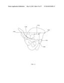 Method And System For Aligning A Prosthesis During Surgery Using Active     Sensors diagram and image