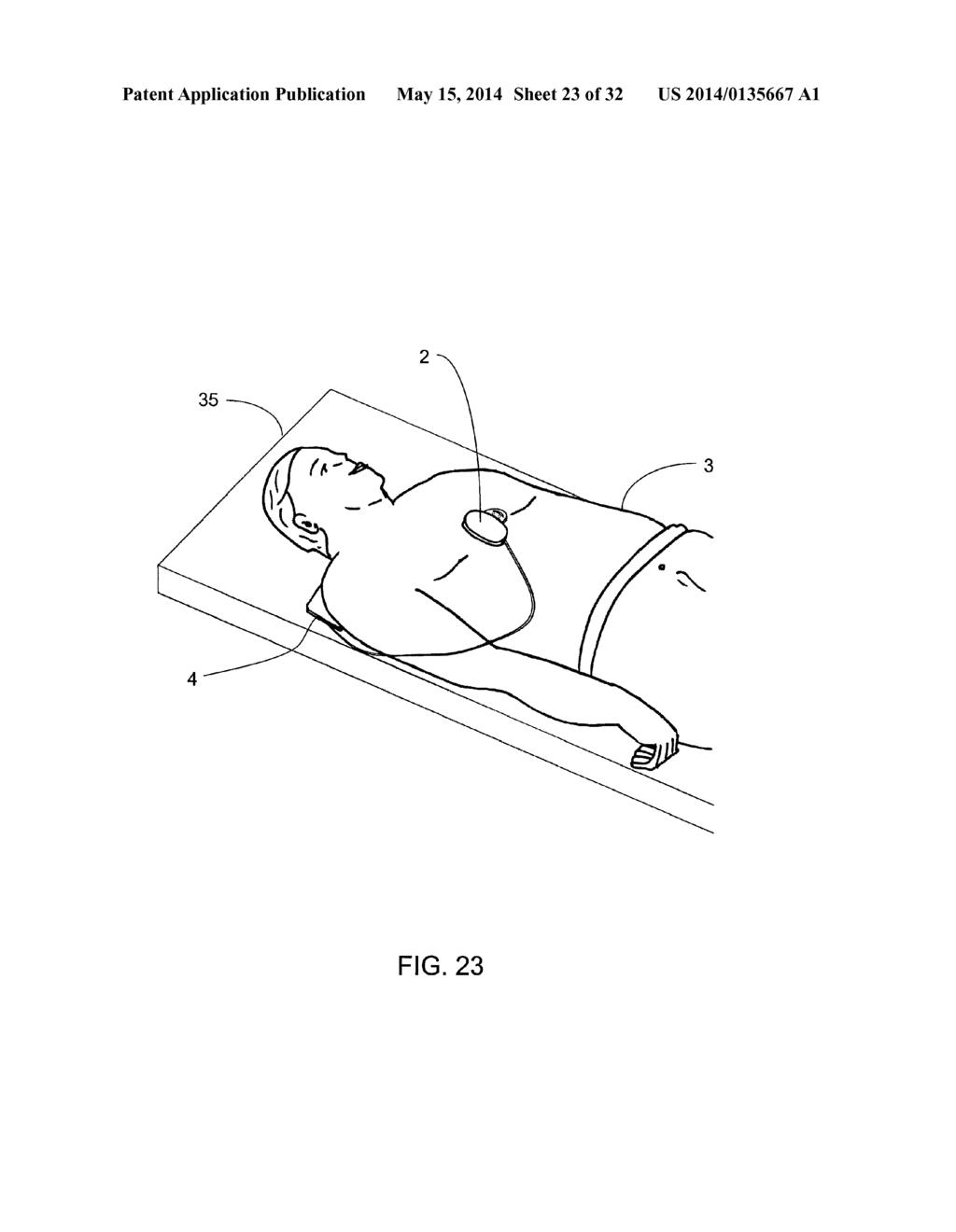 SYSTEM AND METHOD FOR DETERMINING  DEPTH OF CHEST COMPRESSIONS - diagram, schematic, and image 24