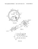 CATHETER WITH FLAT BEAM DEFLECTION IN TIP diagram and image