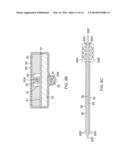 CATHETER WITH FLAT BEAM DEFLECTION IN TIP diagram and image