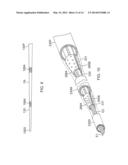 CATHETER WITH FLAT BEAM DEFLECTION IN TIP diagram and image