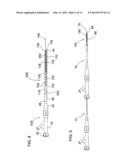 COAXIAL BI-DIRECTIONAL CATHETER diagram and image