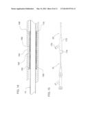 COAXIAL BI-DIRECTIONAL CATHETER diagram and image