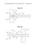 FEMORAL FRACTURE FIXATION DEVICE diagram and image