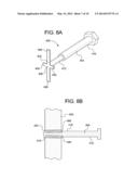 FEMORAL FRACTURE FIXATION DEVICE diagram and image