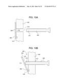 FEMORAL FRACTURE FIXATION DEVICE diagram and image