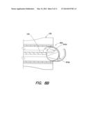 Hingeless Cartridge for Use with an Intraocular Lens Injector Providing     Haptic Control diagram and image