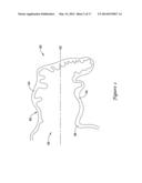 LEFT ATRIAL APPENDAGE CLOSURE IMPLANT diagram and image