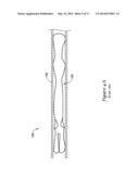 LEFT ATRIAL APPENDAGE CLOSURE IMPLANT diagram and image