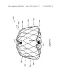 LEFT ATRIAL APPENDAGE CLOSURE IMPLANT diagram and image