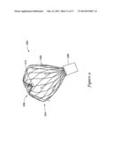 LEFT ATRIAL APPENDAGE CLOSURE IMPLANT diagram and image