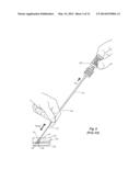 PROCEDURAL SHEATH ADAPTER FOR VASCULAR CLOSURE DEVICE diagram and image