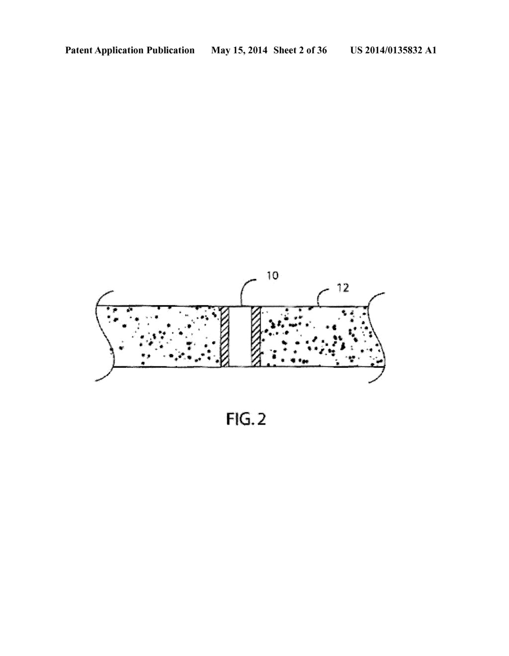 STAPLE TRAP FOR SURGICAL STAPLER - diagram, schematic, and image 03