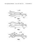 COATED LOOPED SUTURE diagram and image