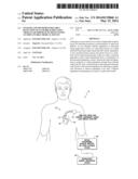 SYSTEMS AND METHODS FOR EARLY DETECTION OF LEAD BREACHES USING CROSS-LEAD     IMPEDANCES DETECTED BY AN IMPLANTABLE MEDICAL DEVICE diagram and image