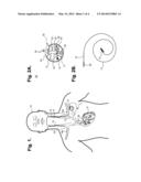 IMPLANTABLE NEUROSTIMULATOR-IMPLEMENTED METHOD FOR ENHANCING POST-EXERCISE     RECOVERY THROUGH VAGUS NERVE STIMULATION diagram and image