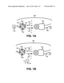 External Unit of an Implanted Medical Device diagram and image