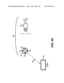 External Unit of an Implanted Medical Device diagram and image