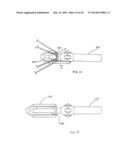 Methods Of Implanting A Prosthesis And Treating An Aneurysm diagram and image