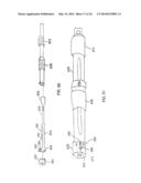 Methods Of Implanting A Prosthesis And Treating An Aneurysm diagram and image