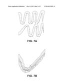 BIOABSORBABLE MEDICAL DEVICE WITH COATING diagram and image