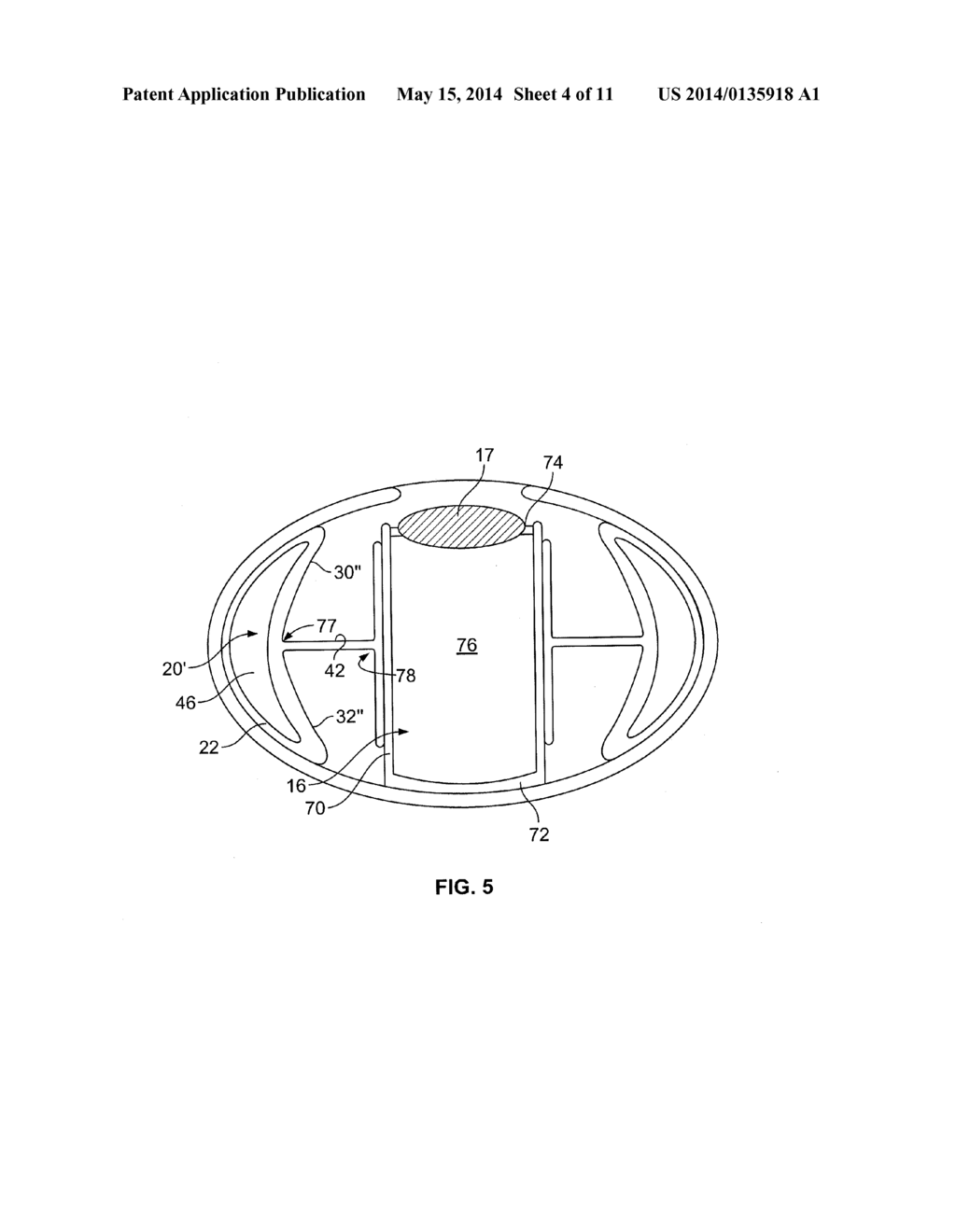 INTRAOCULAR, ACCOMMODATING LENS AND METHODS OF USE - diagram, schematic, and image 05