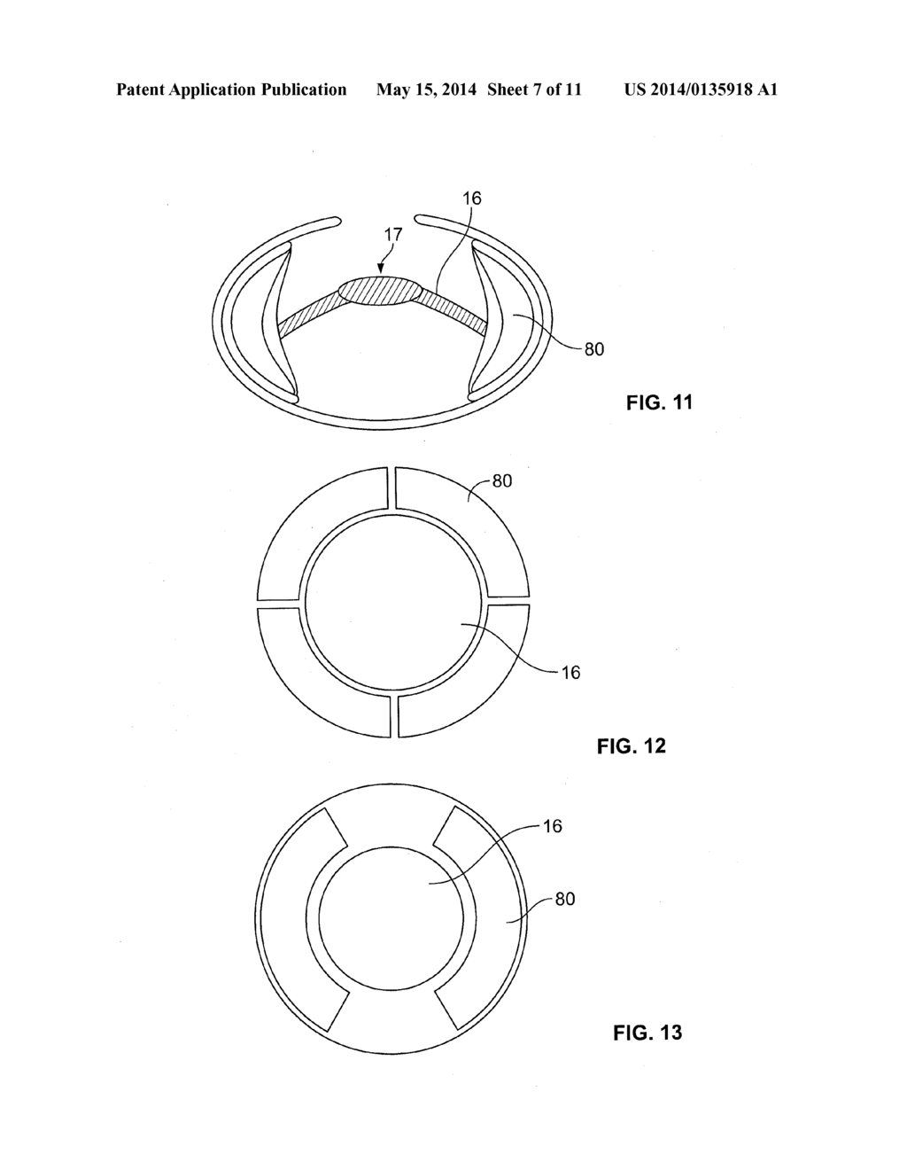 INTRAOCULAR, ACCOMMODATING LENS AND METHODS OF USE - diagram, schematic, and image 08