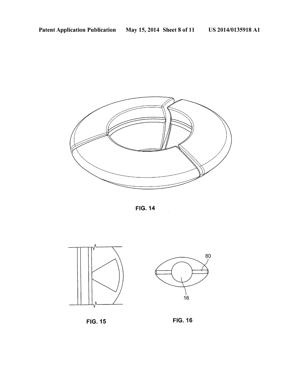 INTRAOCULAR, ACCOMMODATING LENS AND METHODS OF USE - diagram, schematic, and image 09