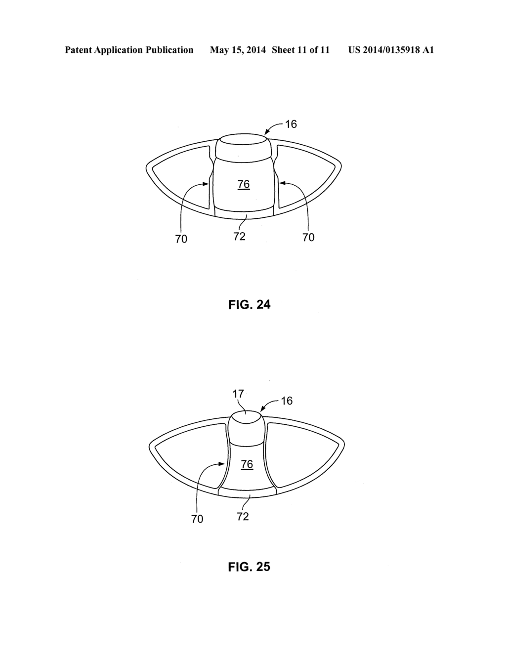 INTRAOCULAR, ACCOMMODATING LENS AND METHODS OF USE - diagram, schematic, and image 12