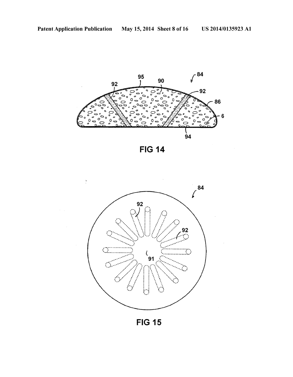 BREAST IMPLANT WITH INTERNAL FLOW DAMPENING - diagram, schematic, and image 09