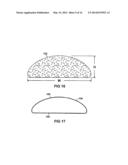 BREAST IMPLANT WITH INTERNAL FLOW DAMPENING diagram and image