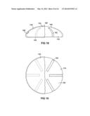 BREAST IMPLANT WITH INTERNAL FLOW DAMPENING diagram and image