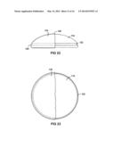 BREAST IMPLANT WITH INTERNAL FLOW DAMPENING diagram and image