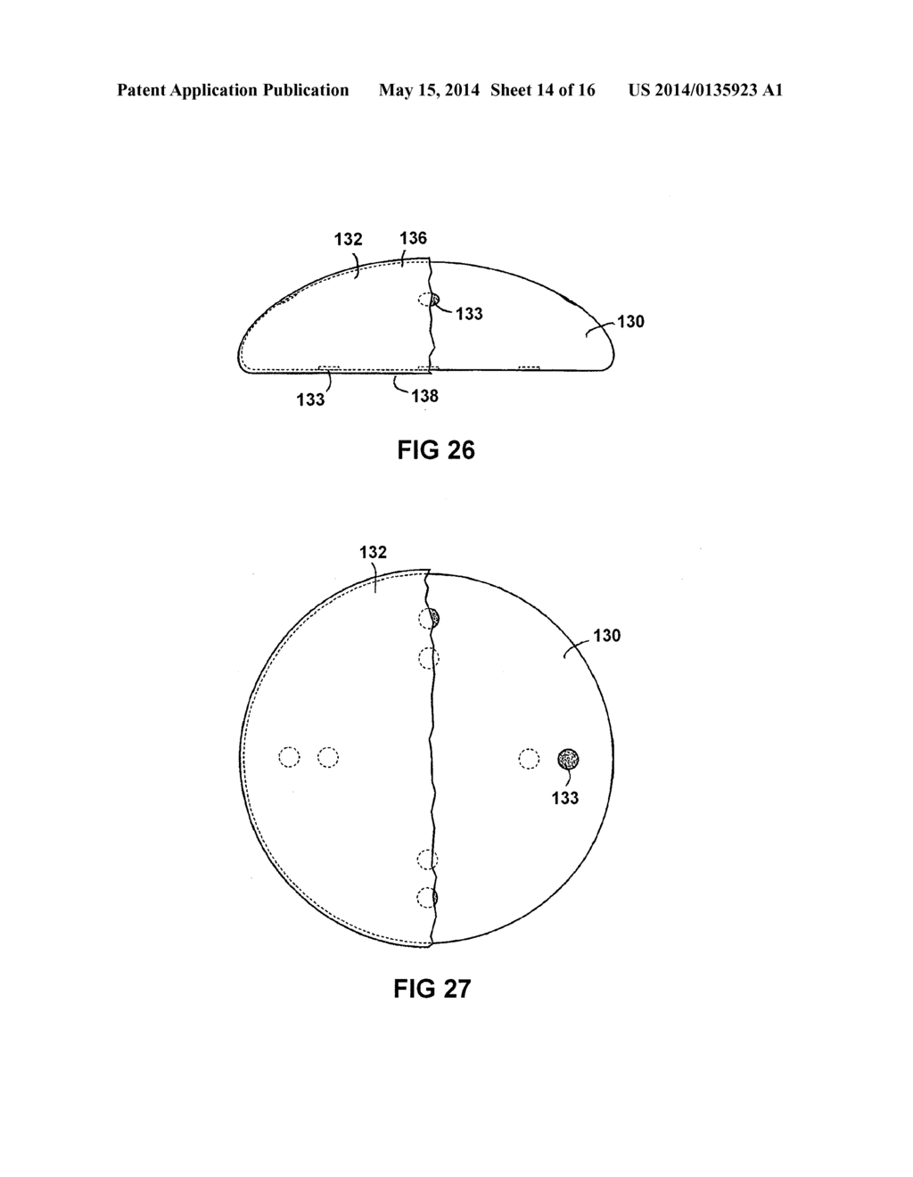 BREAST IMPLANT WITH INTERNAL FLOW DAMPENING - diagram, schematic, and image 15