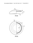 BREAST IMPLANT WITH INTERNAL FLOW DAMPENING diagram and image