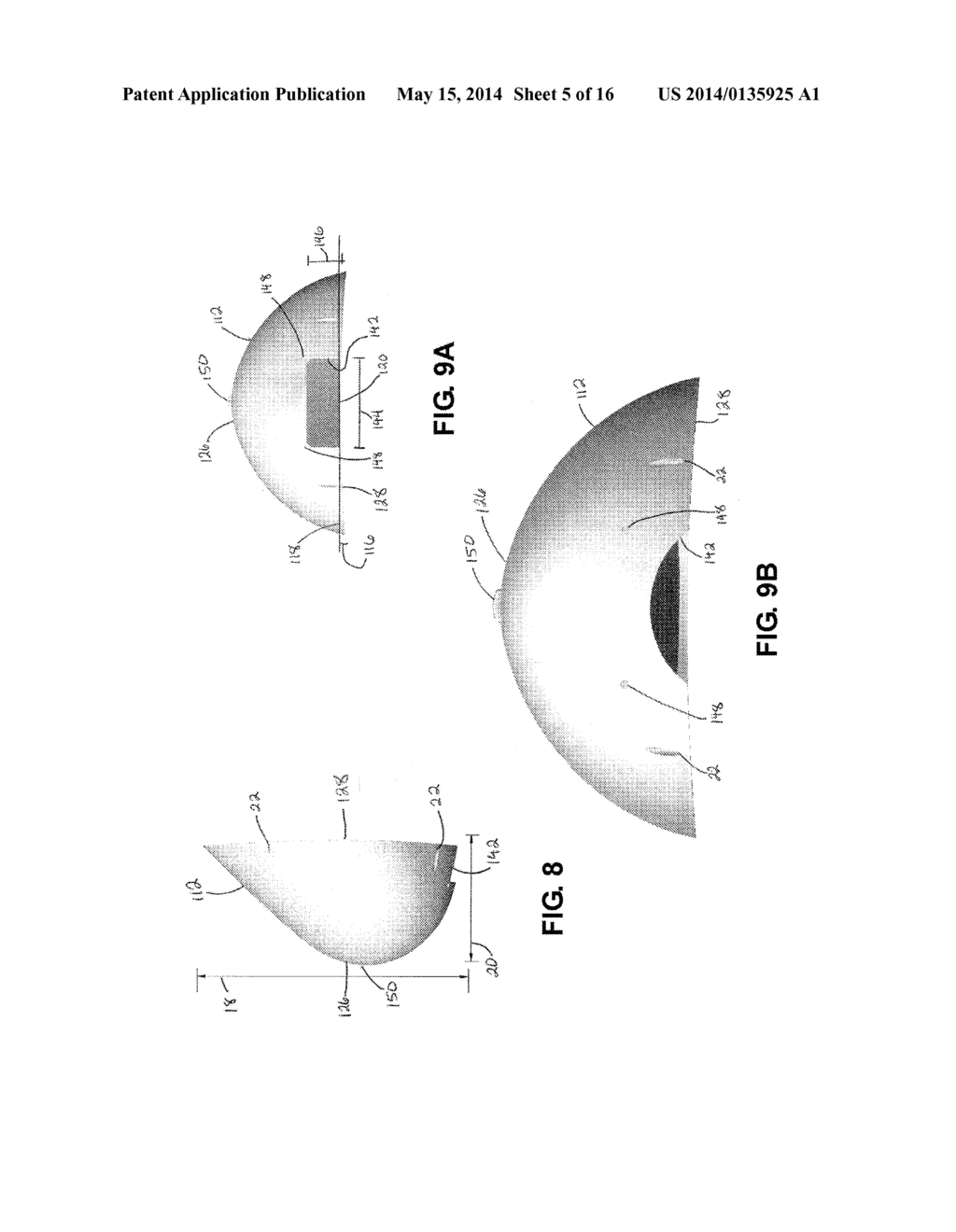 Breast Reconstruction Device and Methods - diagram, schematic, and image 06