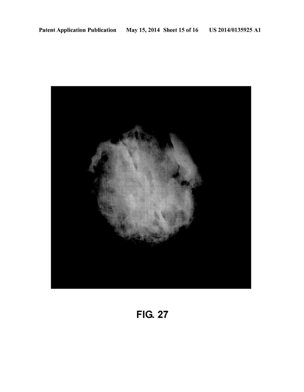 Breast Reconstruction Device and Methods - diagram, schematic, and image 16