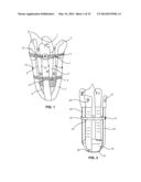 MODULAR PROSTHETIC SOCKETS AND METHODS FOR MAKING SAME diagram and image