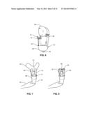 MODULAR PROSTHETIC SOCKETS AND METHODS FOR MAKING SAME diagram and image