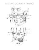 MODULAR PROSTHETIC SOCKETS AND METHODS FOR MAKING SAME diagram and image