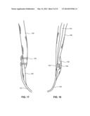 MODULAR PROSTHETIC SOCKETS AND METHODS FOR MAKING SAME diagram and image