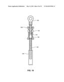 MODULAR PROSTHETIC SOCKETS AND METHODS FOR MAKING SAME diagram and image