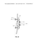 MODULAR PROSTHETIC SOCKETS AND METHODS FOR MAKING SAME diagram and image