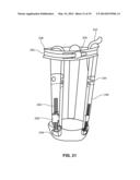 MODULAR PROSTHETIC SOCKETS AND METHODS FOR MAKING SAME diagram and image