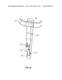 MODULAR PROSTHETIC SOCKETS AND METHODS FOR MAKING SAME diagram and image