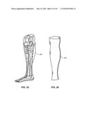 MODULAR PROSTHETIC SOCKETS AND METHODS FOR MAKING SAME diagram and image