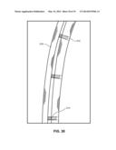 MODULAR PROSTHETIC SOCKETS AND METHODS FOR MAKING SAME diagram and image