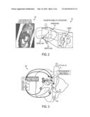 System and Method for Patient Specific Modeling of Liver Tumor Ablation diagram and image