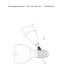 INFECTED DENTAL IMPLANT CLEANING TECHNIQUE diagram and image